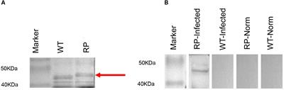 Efficient Treatment of Sporothrix globosa Infection Using the Antibody Elicited by Recombinant Phage Nanofibers